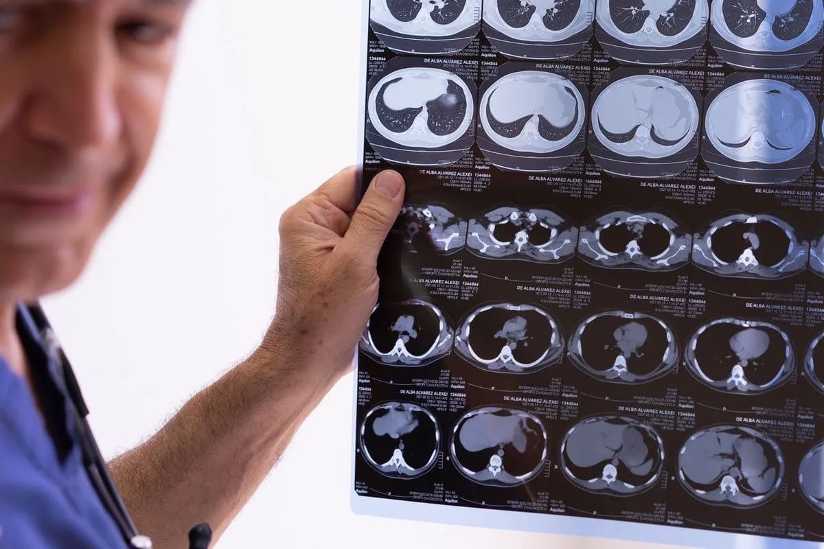 Hangi Durumlarda Distal Pankreatektomi Yapılır?